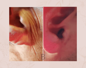 Resultados Compositum 10