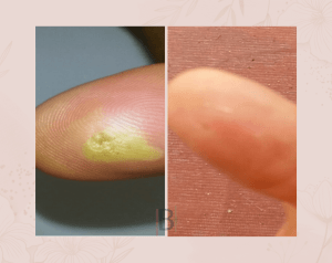 Resultados Compositum 9